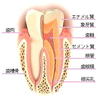 虫歯 駒込 丸山歯科医院 虫歯治療・むし歯・歯の痛み・子供の ...